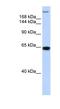 Trinucleotide Repeat Containing Adaptor 6A antibody, NBP1-57134, Novus Biologicals, Western Blot image 