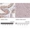 Nucleoporin 50 antibody, NBP2-13683, Novus Biologicals, Immunohistochemistry paraffin image 