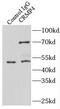 Dihydropyrimidinase Like 3 antibody, FNab01989, FineTest, Immunoprecipitation image 