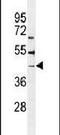 Beta-1,4-Galactosyltransferase 6 antibody, PA5-24190, Invitrogen Antibodies, Western Blot image 