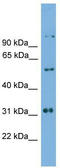 Iroquois Homeobox 2 antibody, TA342271, Origene, Western Blot image 
