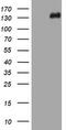 TSC Complex Subunit 1 antibody, CF802012, Origene, Western Blot image 