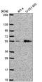 Solute Carrier Family 29 Member 4 antibody, HPA052829, Atlas Antibodies, Western Blot image 