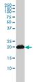 RAP2B, Member Of RAS Oncogene Family antibody, H00005912-M01, Novus Biologicals, Western Blot image 