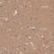 Rho GDP Dissociation Inhibitor Alpha antibody, NBP2-49264, Novus Biologicals, Immunohistochemistry frozen image 