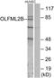 Olfactomedin Like 2B antibody, GTX87915, GeneTex, Western Blot image 