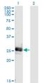 Noggin antibody, H00009241-M04, Novus Biologicals, Western Blot image 