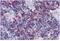 Lymphocyte Cytosolic Protein 2 antibody, GTX14942, GeneTex, Immunohistochemistry paraffin image 