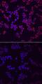 Phospholipase C Gamma 2 antibody, MAB7377, R&D Systems, Immunocytochemistry image 
