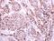 Programmed Cell Death 6 antibody, GTX102195, GeneTex, Immunohistochemistry paraffin image 