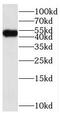 Serine/Threonine/Tyrosine Kinase 1 antibody, FNab08366, FineTest, Western Blot image 