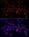 Alanyl-TRNA Synthetase antibody, 15-833, ProSci, Immunofluorescence image 