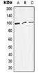 Dynamin 1 antibody, orb213854, Biorbyt, Western Blot image 