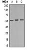 Iroquois-class homeodomain protein IRX-3 antibody, orb256633, Biorbyt, Western Blot image 