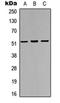 Iroquois Homeobox 3 antibody, orb256633, Biorbyt, Western Blot image 