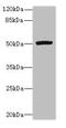 Probable protein-cysteine N-palmitoyltransferase porcupine antibody, CSB-PA887958LA01HU, Cusabio, Western Blot image 