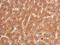 Transferrin Receptor 2 antibody, GTX110441, GeneTex, Immunohistochemistry paraffin image 