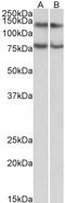 WD Repeat And FYVE Domain Containing 3 antibody, 43-629, ProSci, Enzyme Linked Immunosorbent Assay image 