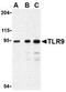 Toll Like Receptor 9 antibody, TA306291, Origene, Western Blot image 