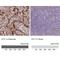 Fms Related Tyrosine Kinase 1 antibody, NBP2-30982, Novus Biologicals, Immunohistochemistry paraffin image 