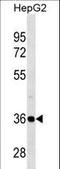 Proteasome 26S Subunit, Non-ATPase 14 antibody, LS-C158750, Lifespan Biosciences, Western Blot image 