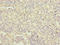 F-Box And Leucine Rich Repeat Protein 5 antibody, LS-C675743, Lifespan Biosciences, Immunohistochemistry paraffin image 