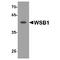 WD Repeat And SOCS Box Containing 1 antibody, TA349166, Origene, Western Blot image 