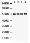 Pyruvate Kinase M1/2 antibody, LS-C357572, Lifespan Biosciences, Western Blot image 