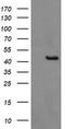 Gamma-Butyrobetaine Hydroxylase 1 antibody, LS-C174520, Lifespan Biosciences, Western Blot image 