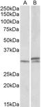 Insulin Like Growth Factor 2 MRNA Binding Protein 1 antibody, 42-596, ProSci, Enzyme Linked Immunosorbent Assay image 