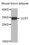 Mitochondrial brown fat uncoupling protein 1 antibody, STJ29316, St John