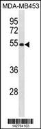 Eukaryotic Translation Initiation Factor 2 Subunit Beta antibody, 60-960, ProSci, Western Blot image 