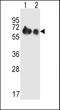 Solute Carrier Family 3 Member 2 antibody, LS-C161247, Lifespan Biosciences, Western Blot image 