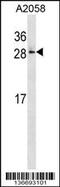 RAB28, Member RAS Oncogene Family antibody, 58-854, ProSci, Western Blot image 