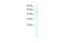 Chromodomain Helicase DNA Binding Protein 1 Like antibody, 28-481, ProSci, Western Blot image 