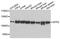 Splicing Factor Proline And Glutamine Rich antibody, A0958, ABclonal Technology, Western Blot image 