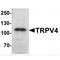 Transient Receptor Potential Cation Channel Subfamily V Member 4 antibody, MBS153648, MyBioSource, Western Blot image 
