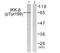 Inhibitor Of Nuclear Factor Kappa B Kinase Subunit Beta antibody, PA5-38280, Invitrogen Antibodies, Western Blot image 