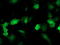 Deoxythymidylate Kinase antibody, LS-C173283, Lifespan Biosciences, Immunofluorescence image 
