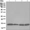 Profilin 1 antibody, ab124904, Abcam, Western Blot image 