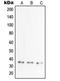 TNF Alpha Induced Protein 6 antibody, orb214683, Biorbyt, Western Blot image 