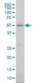 Cytochrome P450 Family 2 Subfamily J Member 2 antibody, H00001573-M01, Novus Biologicals, Western Blot image 