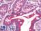 Tubulin Gamma Complex Associated Protein 4 antibody, LS-B9836, Lifespan Biosciences, Immunohistochemistry frozen image 