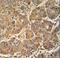ATP Synthase F1 Subunit Delta antibody, LS-C156656, Lifespan Biosciences, Immunohistochemistry paraffin image 