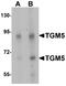 Transglutaminase-5 antibody, A08563, Boster Biological Technology, Western Blot image 