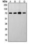 Ribosomal Protein S6 Kinase B1 antibody, LS-C352824, Lifespan Biosciences, Western Blot image 