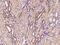 Fibronectin Type III Domain Containing 4 antibody, 202523-T10, Sino Biological, Immunohistochemistry paraffin image 