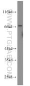 Plasminogen Activator, Urokinase Receptor antibody, 10286-1-AP, Proteintech Group, Western Blot image 