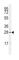 Snail Family Transcriptional Repressor 1 antibody, abx031512, Abbexa, Western Blot image 