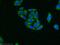 Casein Kinase 2 Alpha 1 antibody, 10992-1-AP, Proteintech Group, Immunofluorescence image 